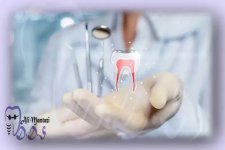 10-Reasons-Why-You-Should-Not-Fear-a-Root-Canal.jpg